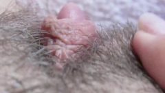 Extreme Close Up On My Hairy Enormous Clit Pussy